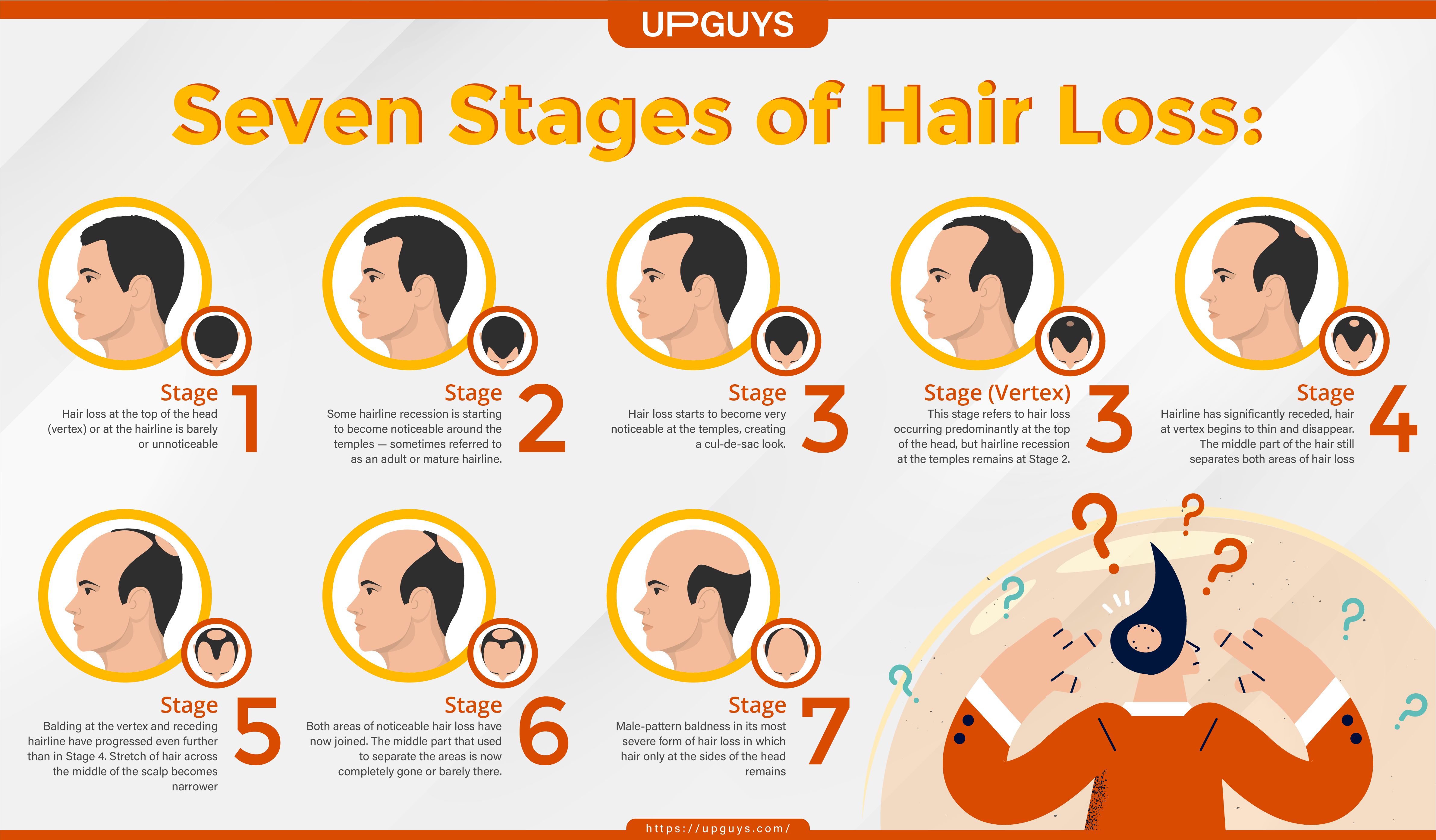 The Receding Hairline Stages For Men Women Ds The Receding Hairline Stages For Men Women Ds